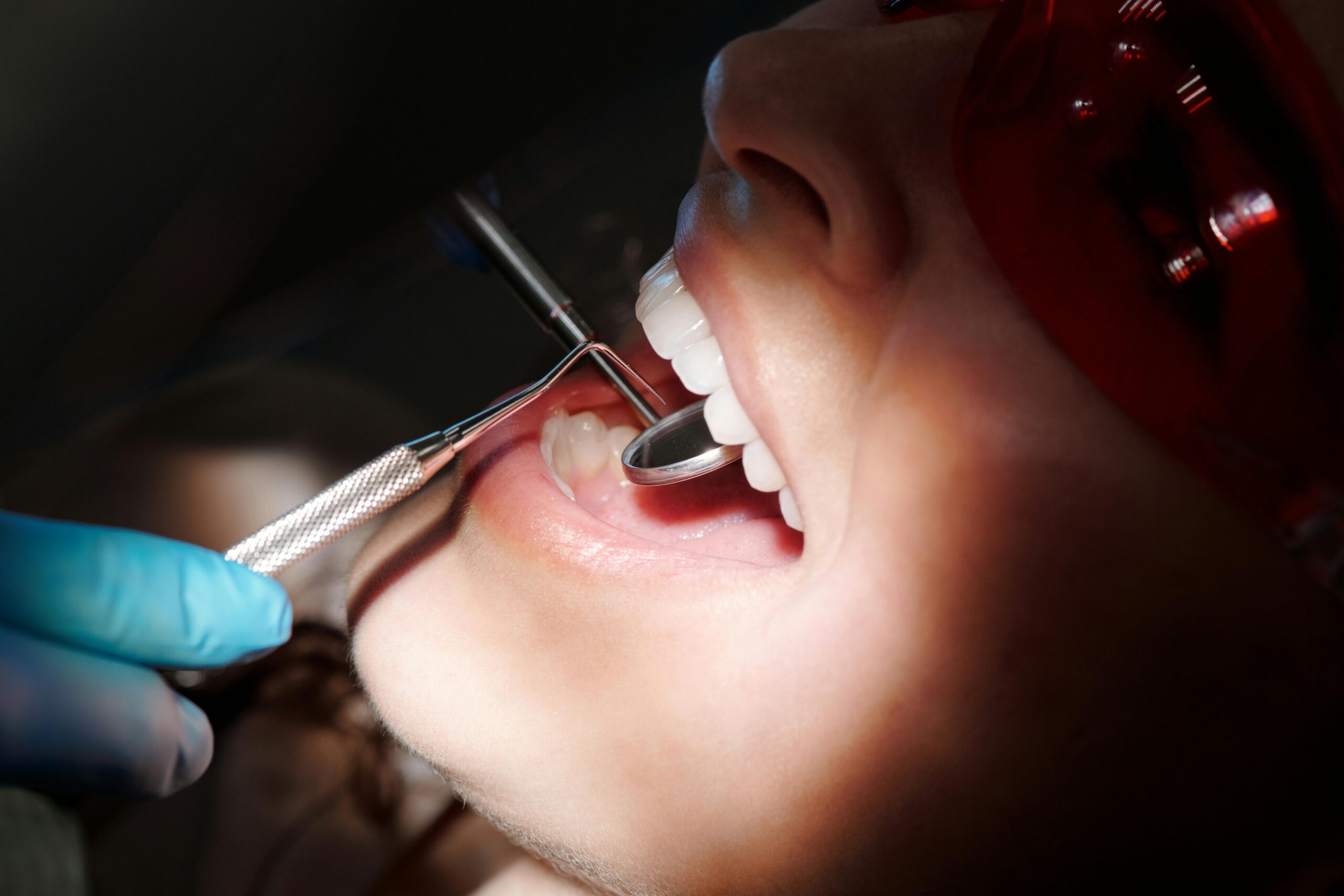 The dentist checks the teeth