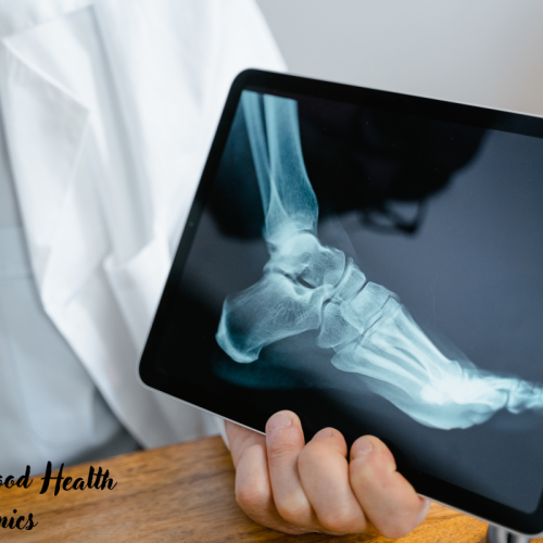 What are the Best Foot and Ankle Clinics in Australia